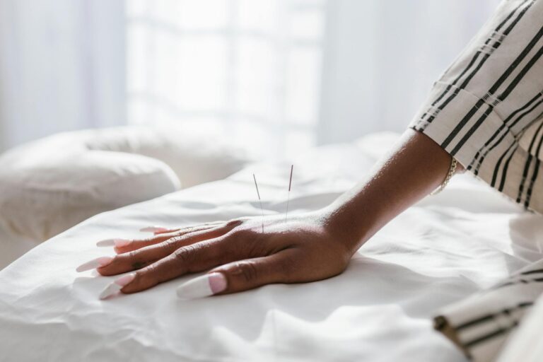 Using Acupuncture for Menstrual Cycle Pain: My Experience